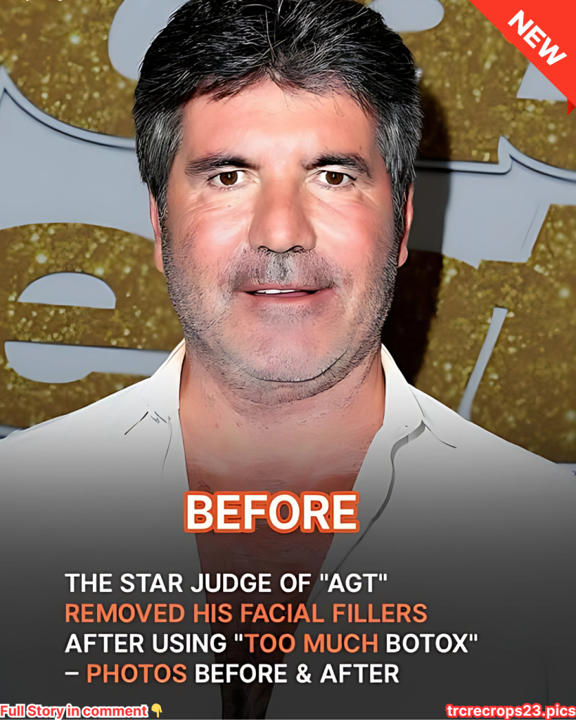 ‘AGT’ Star Simon Cowell Removed His Facial Fillers After Not Recognizing Himself – Before & After Photos