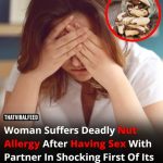 Woman Suffers Severe Nut Allergy After Having Sex With Partner In Unprecedented Case By maks in Relationships On 4th February 2025