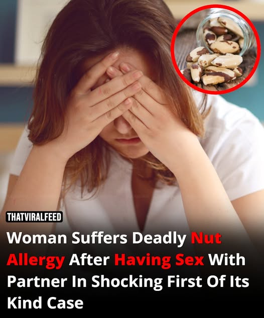 Woman Suffers Severe Nut Allergy After Having Sex With Partner In Unprecedented Case By maks in Relationships On 4th February 2025