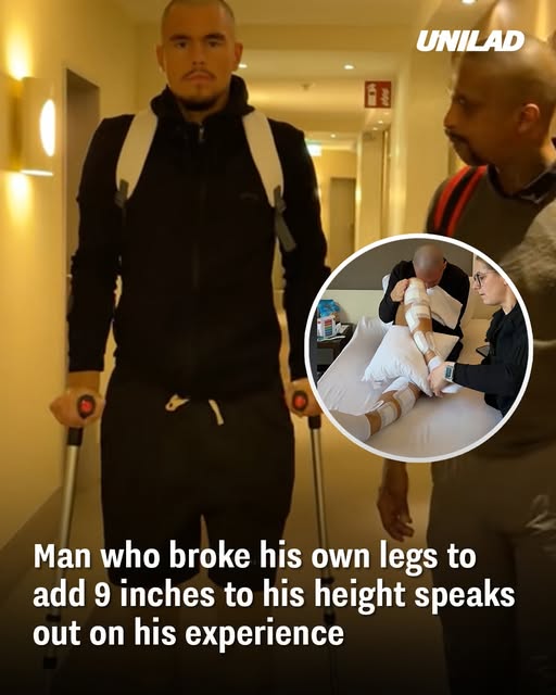 Man who broke his own legs to add 9 inches to his height speaks out on his experience