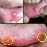 !! BE CAREFUL If it comes out of your mouth, you are infected with… See more