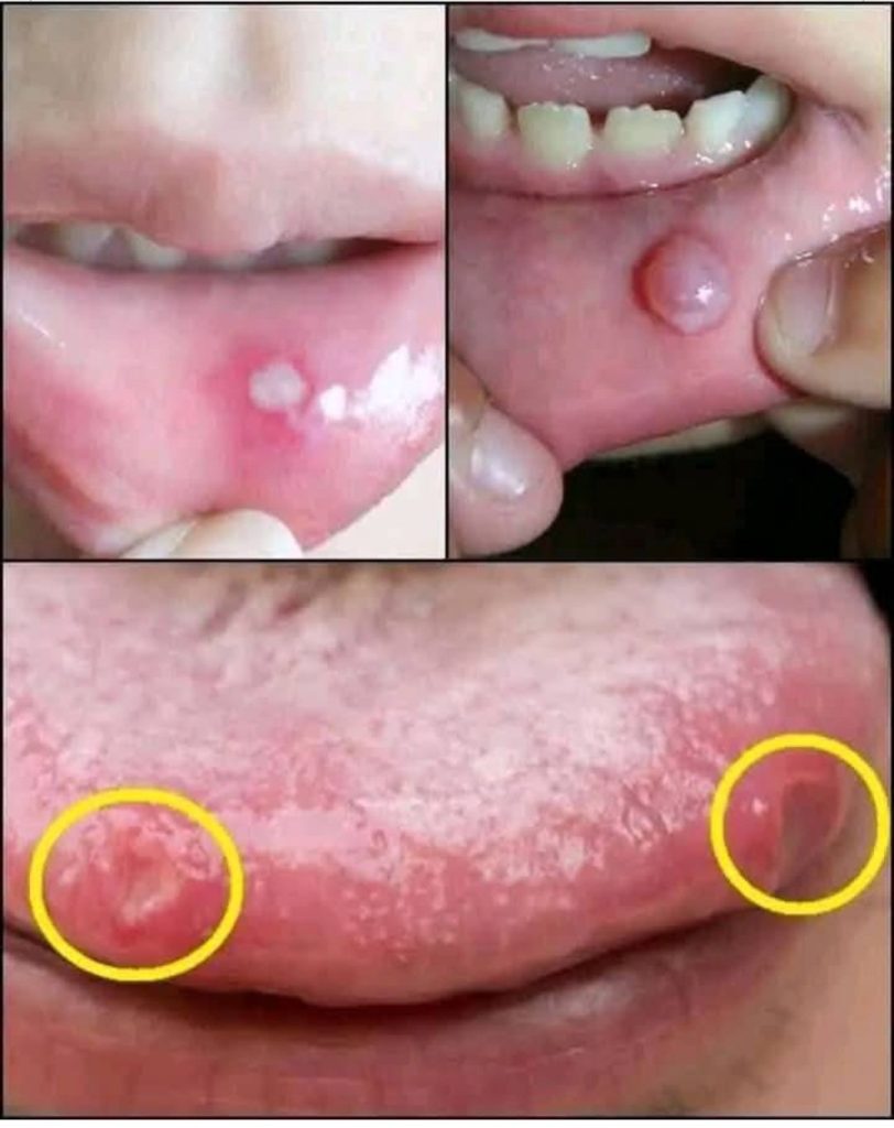 !! BE CAREFUL If it comes out of your mouth, you are infected with… See more