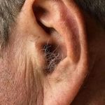 🚨 DID YOU KNOW that if hair grows on your ears, it’s because your body is… see more