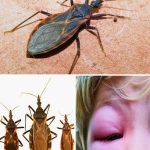 The Rise of Kissing Bugs