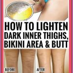 How To Lighten Dark Inner Thighs Naturally