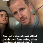 Bachelor star almost killed by his own family dog after two brutal attacks in 12 hours