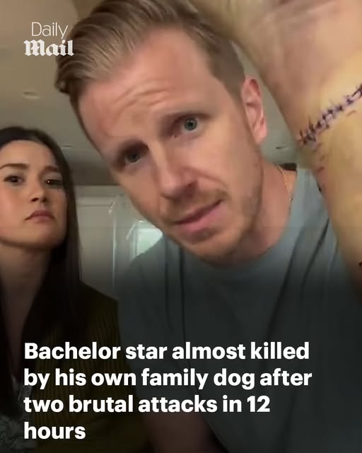 Bachelor star almost killed by his own family dog after two brutal attacks in 12 hours