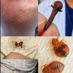 ⚠️ BE CAREFUL, If you spot these dots on your skin, it means you have Ca…see more