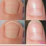 If You Don’t Have A Half Moon Shape On Your Nails, Visit A DOCTOR Immediately…