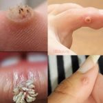 BE VERY CAREFUL 🤧🤧 . If you get this, you are infected with …. See more