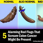5 Concerning Red Flags That May Signal Colon Cancer
