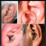 Did you know that if your ear hairs grow, it is because your body is