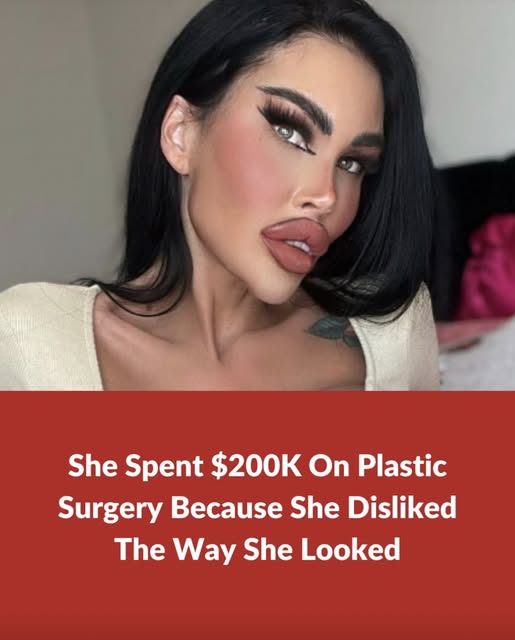 Plastic surgery addict spends $200K on plastic surgery