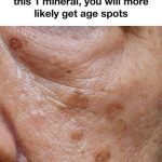 How To Reduce Age Spots: Causes, Treatment, and Prevention