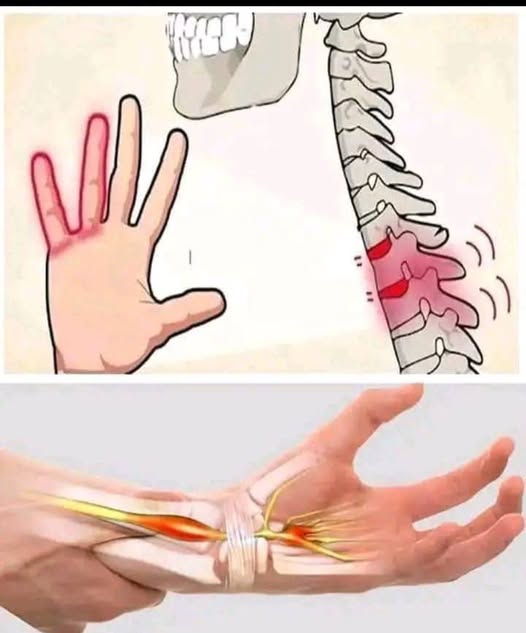 🚦If your HANDS fall asleep it’s a clear sign that you have can… See more👇