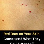 11 Reasons Why You Have Red Dots On Your Skin