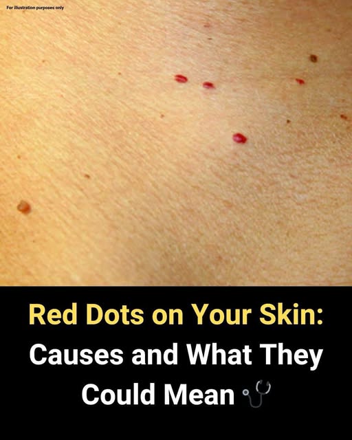 11 Reasons Why You Have Red Dots On Your Skin
