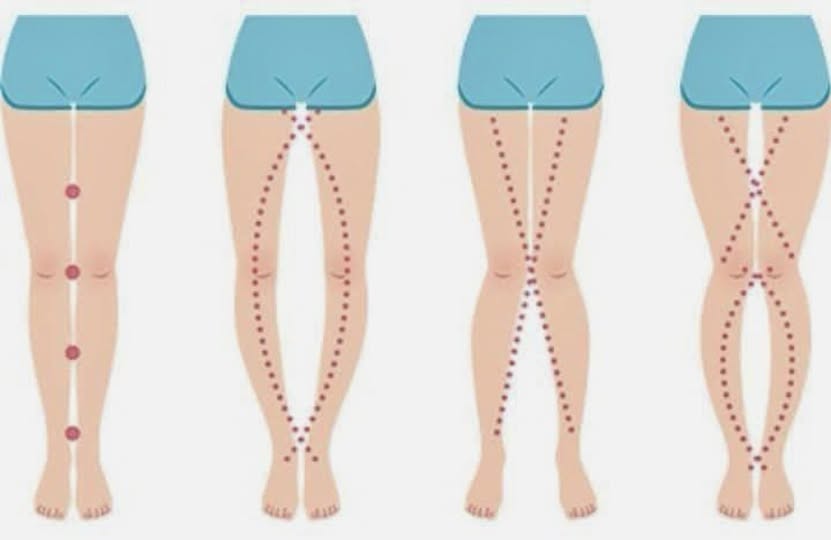 THE LEGS OF A WOMAN CAN SAY AS IT IS THEIR VAGIN…. Read more