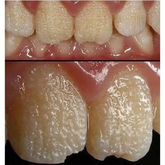 Be careful!! This is what your teeth will become when you eat…see more