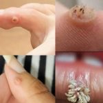 BE VERY CAREFUL 🚨. If you get this, you are infected with …. See more