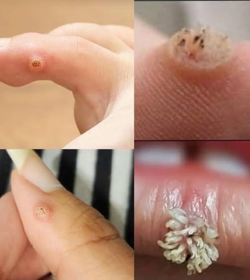 BE VERY CAREFUL 🚨. If you get this, you are infected with …. See more