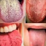 !! BE CAREFUL If it comes out of your mouth…