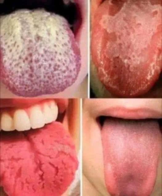 !! BE CAREFUL If it comes out of your mouth…