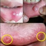 BE VERY CAREFUL . If you get this, you are infected with …. Read more