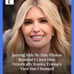 Jarring Side❤️ By Side Photos Remind Us Just How Drastically Ivanka Trump’s Face Has Changed  Read More: https://www.thelist.com/1921656/ivanka-trump-brown-hair-throwback-pic-younger/
