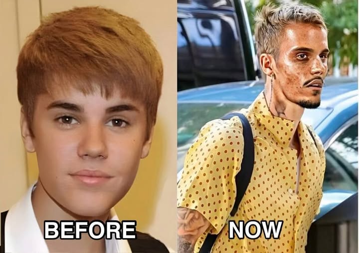 Justin Bieber admits that he tested positive for…See More