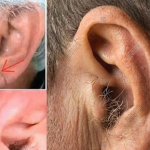 Did you know that if your ear hairs grow, it is because your body is…