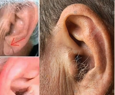 Did you know that if your ear hairs grow, it is because your body is…