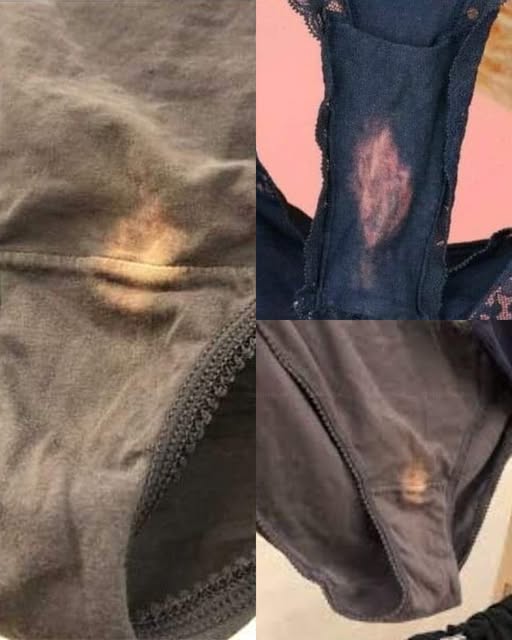 What Those “Bleach” Stains on Your Underwear Really Mean
