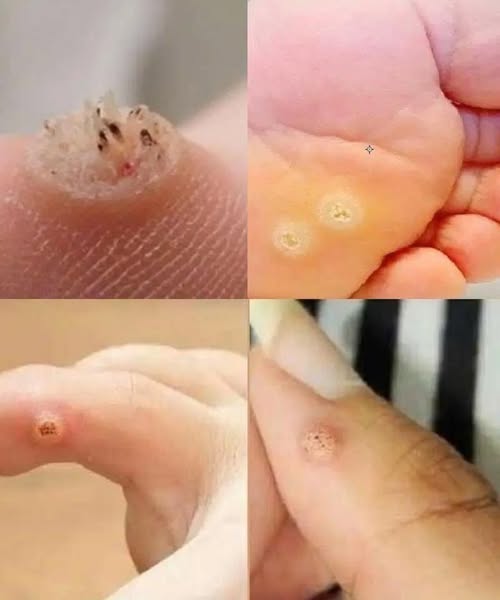 Be very careful if it comes out in your mouth, you are!