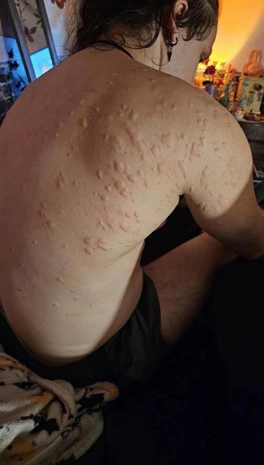 HT10. These are the consequences of sleeping with…see more