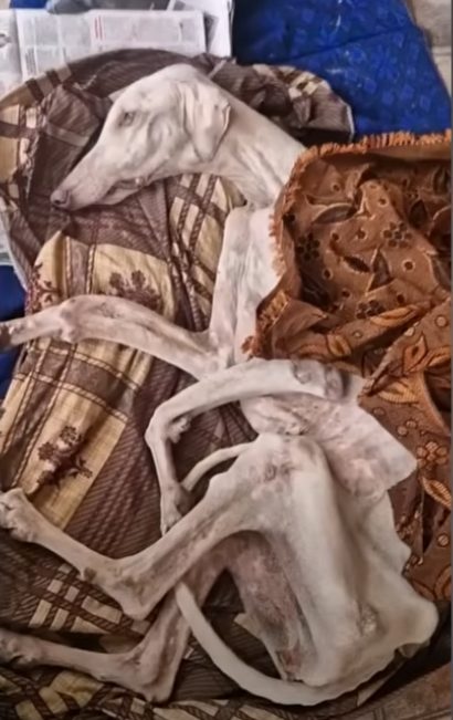 She Stumbled Down the Road, but Her Eyes Still Held Hope