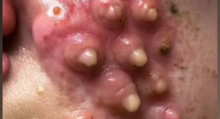 FS. 10 symptoms that your body is not right