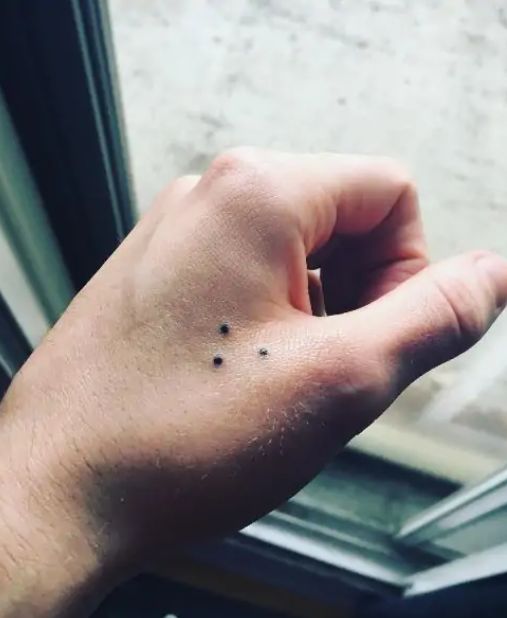 What That Little Mark Could Be Telling You: A Closer Look You Can’t Ignore