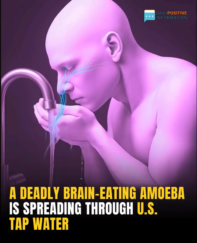 A Deadly Brain-Eating Amoeba Is Spreading Through U.S. Tap Water—Naegleria Fowleri