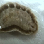 If You Spot This “Cute” And Fuzzy Insect In Your Yard, You Had Better Know What It Is