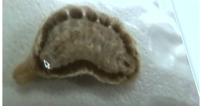 If You Spot This “Cute” And Fuzzy Insect In Your Yard, You Had Better Know What It Is